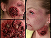 Zombie Wounds